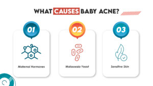 What Causes Baby Acne?