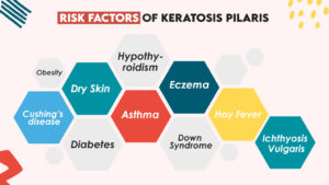 Risk Factors of Keratosis Pilaris