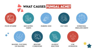 What Causes Fungal Acne?