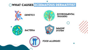 Causes of Atopic Dermatitis