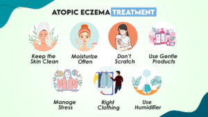 Atopic Eczema Treatment