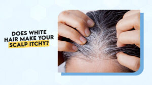 White Hair Vs Itchy Scalp