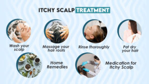 Itchy Scalp Treatment