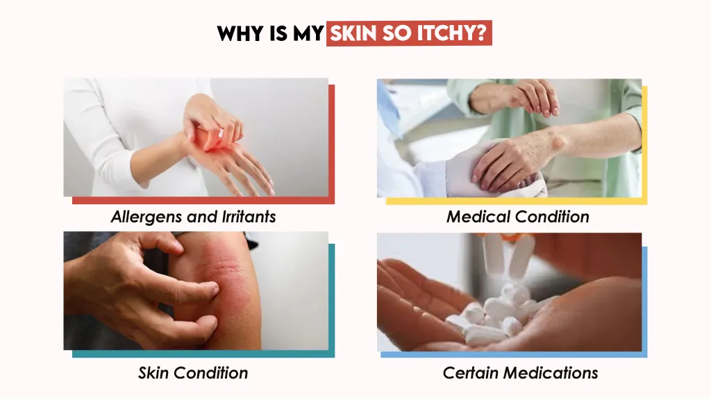 Why is My Skin So Itchy?