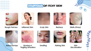 Symptoms of Itchy Skin
