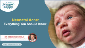 Neonatal Acne