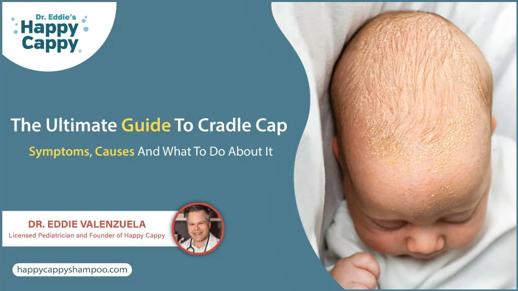 The Ultimate Guide To Cradle Cap: Symptoms, Causes And What To Do About It 