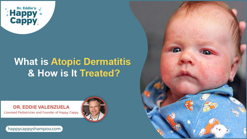 What is Atopic Dermatitis