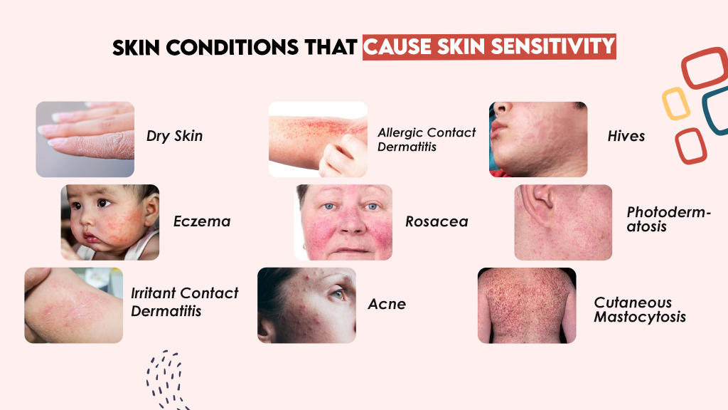 Skin Conditions That Cause Skin Sensitivity