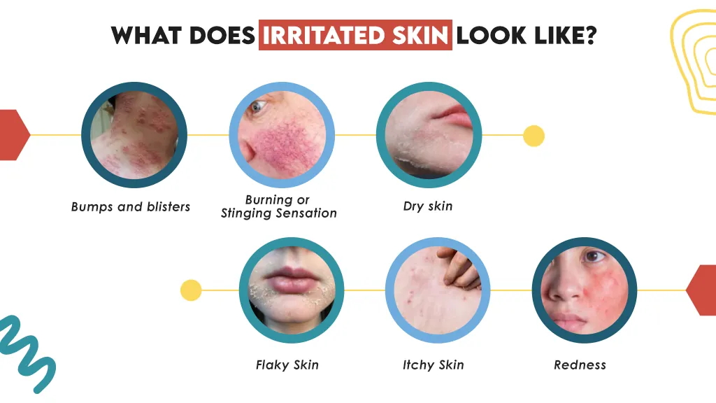 What Does Irritated Skin Look Like