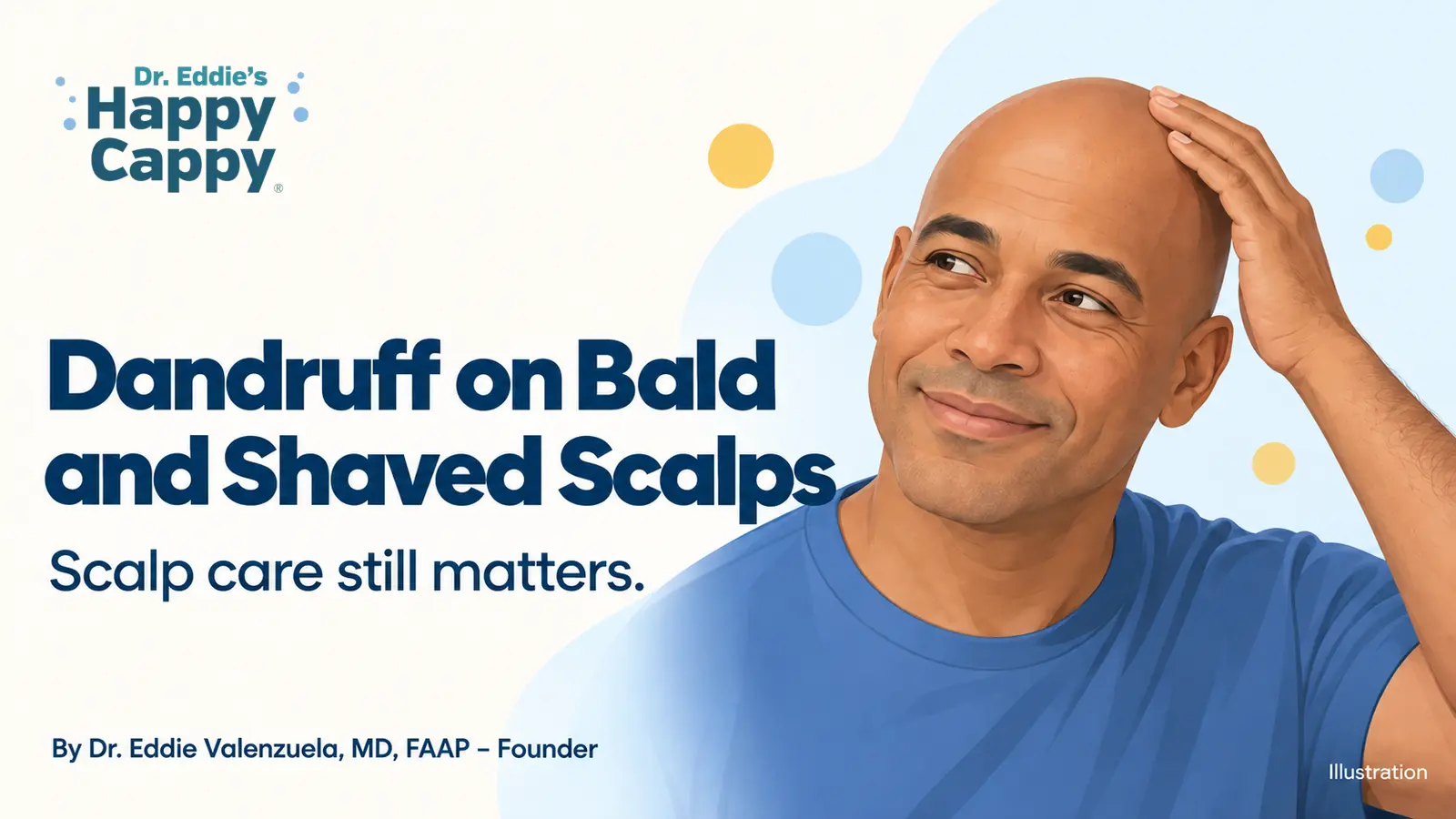 Dandruff on Bald and Shaved Scalps