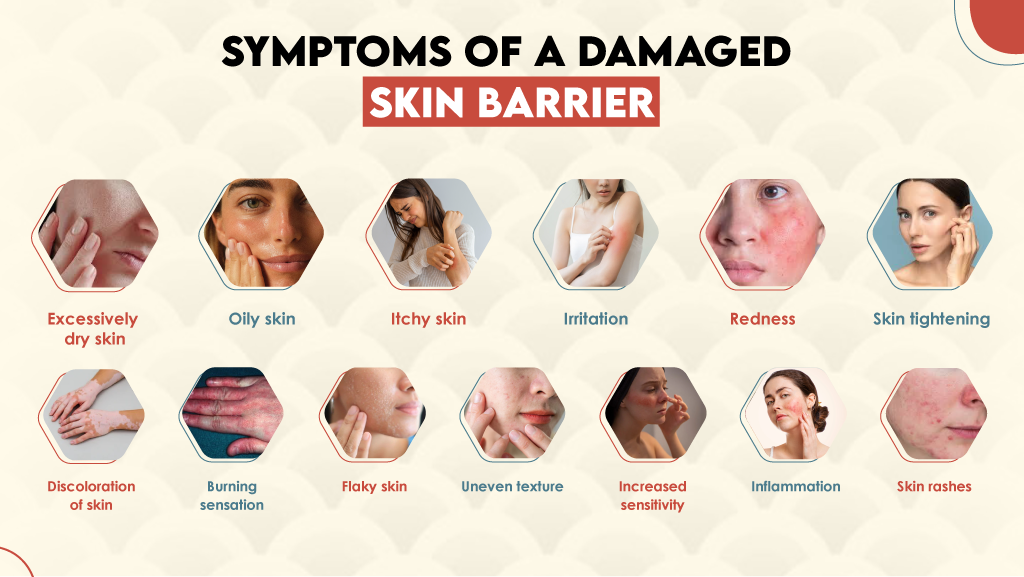 Symptoms of a Damaged Skin Barrier