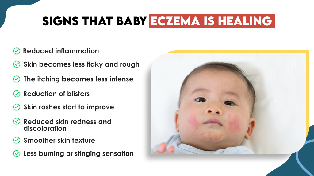 Signs That Baby Eczema is Healing