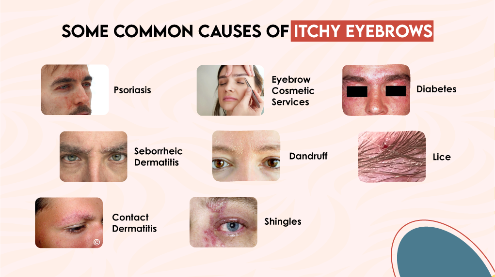 Some Common Causes of Itchy Eyebrows Some Common Causes of Itchy Eyebrows