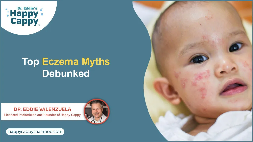 Top Eczema Myths