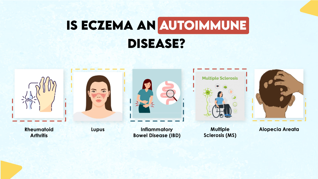 Is Eczema an Autoimmune Disease?