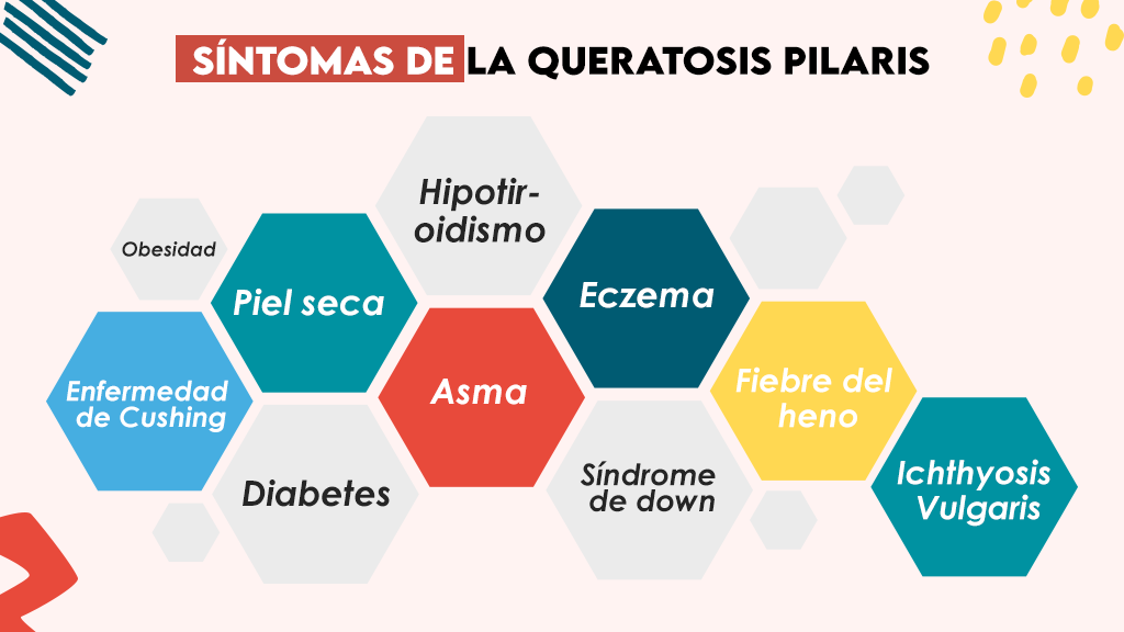 Factores de riesgo de KP