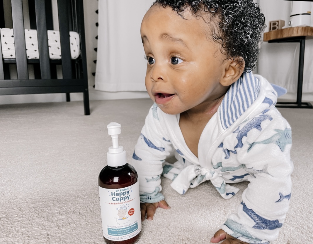 Can Cradle Cap Cause Hair Loss in Babies?