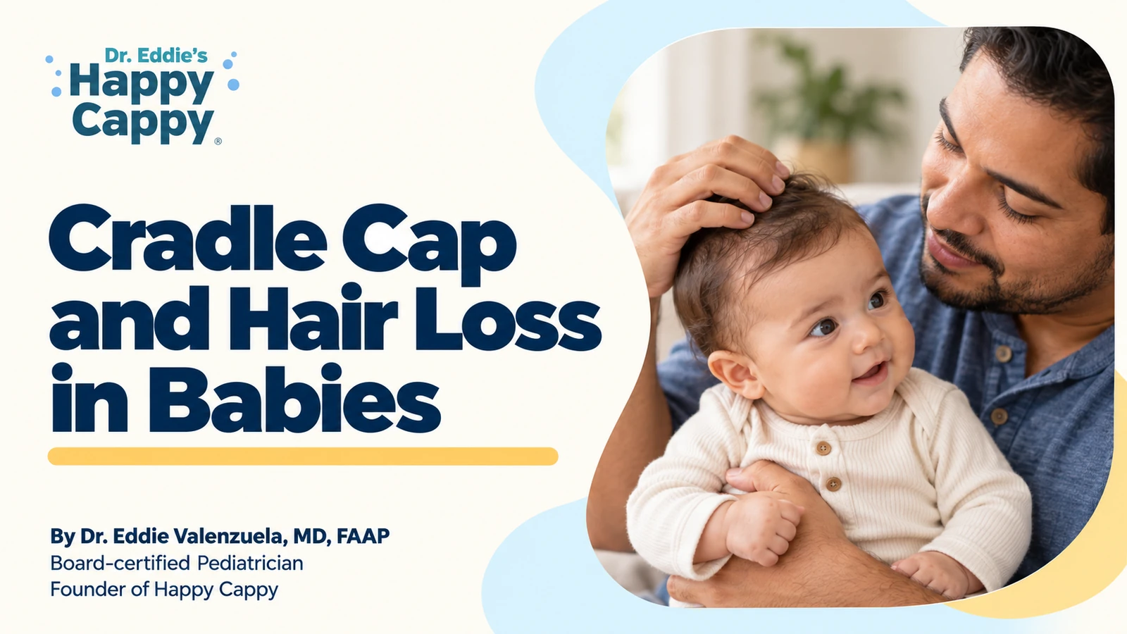 Cradle Cap and Hair Loss in Babies
