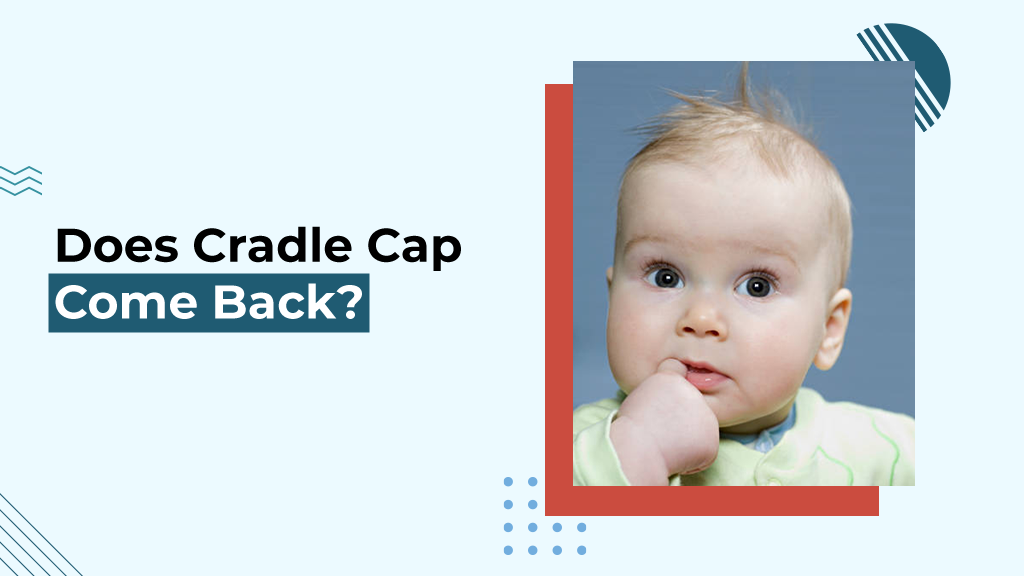 Does Cradle Cap Come Back?  