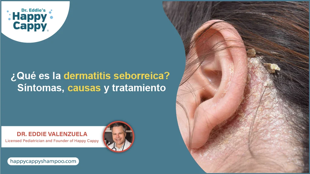 ¿Qué es la dermatitis seborreica? Síntomas, causas y tratamiento