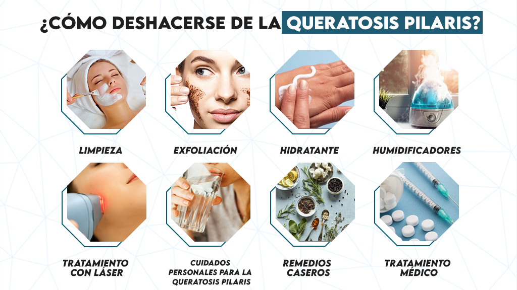 ¿Cómo deshacerse de la queratosis pilaris?