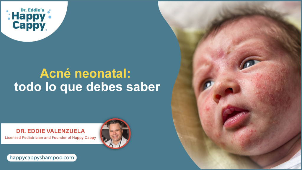 Acné neonatal: todo lo que debes saber