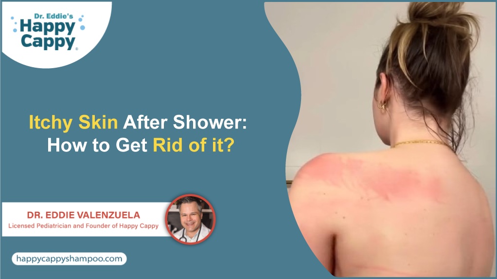 Itchy Skin After Shower: How to Get Rid of it?