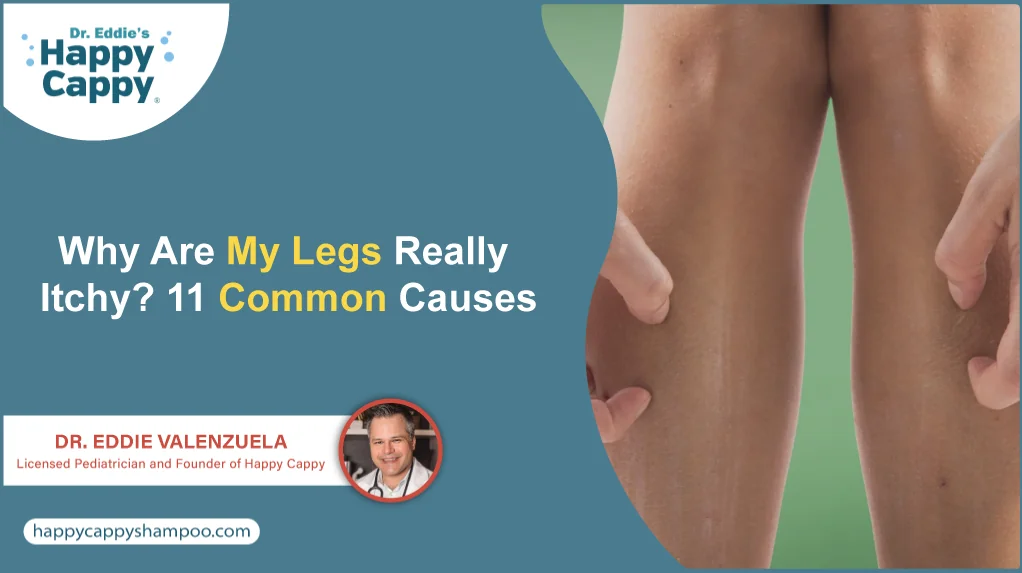 Why Are My Legs Really Itchy? 11 Common Causes