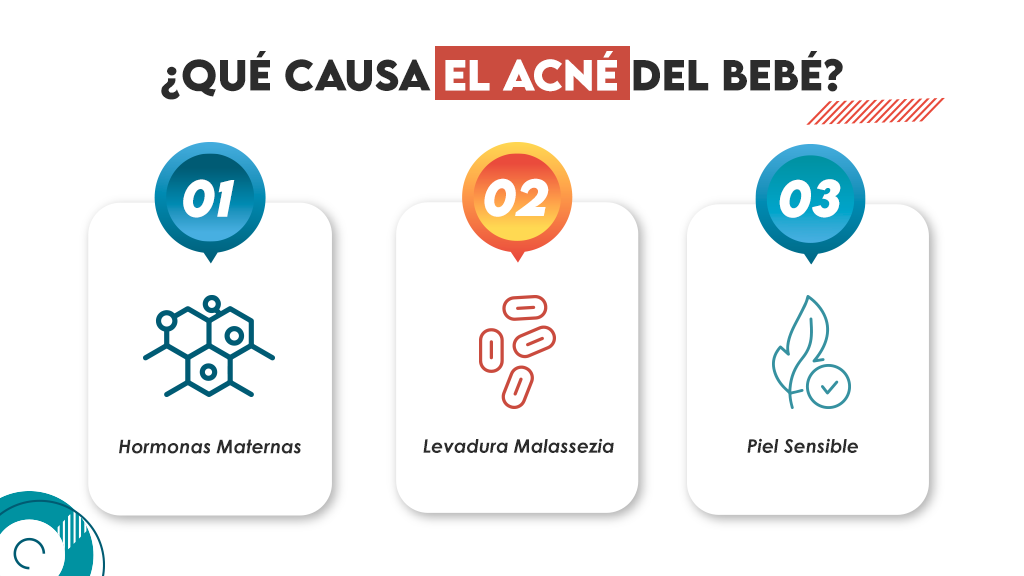 ¿Qué causa el acné del bebé?