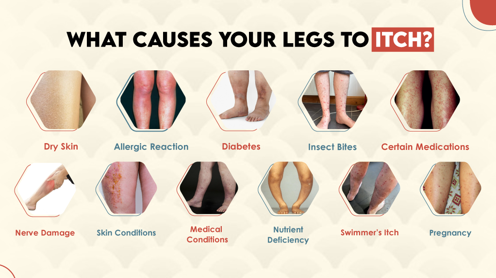 What Causes Your Legs to Itch?