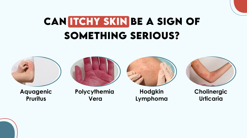 Can Itchy Skin Be a Sign of Something Serious?