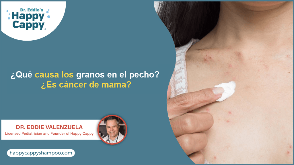 ¿Qué causa los granos en el pecho?