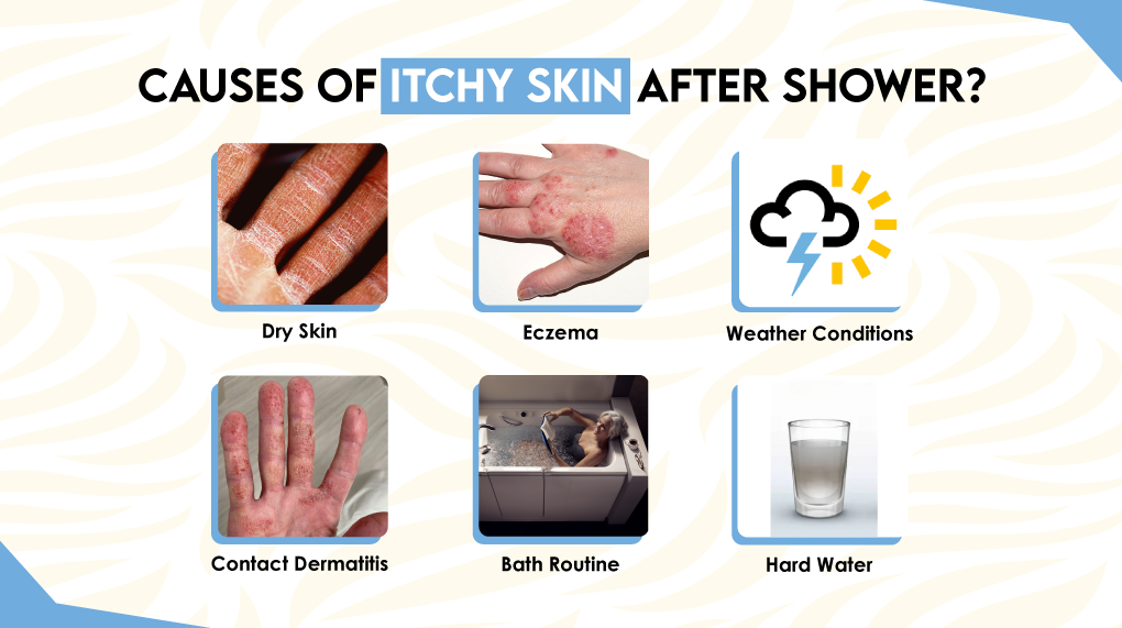 Causes of Itchy Skin After Shower?