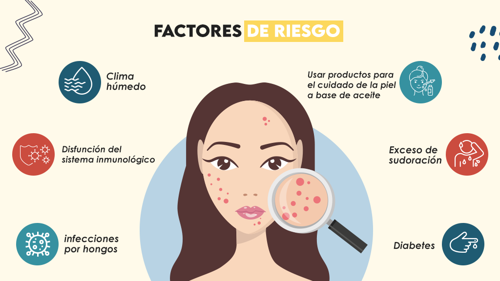 Factores de riesgo