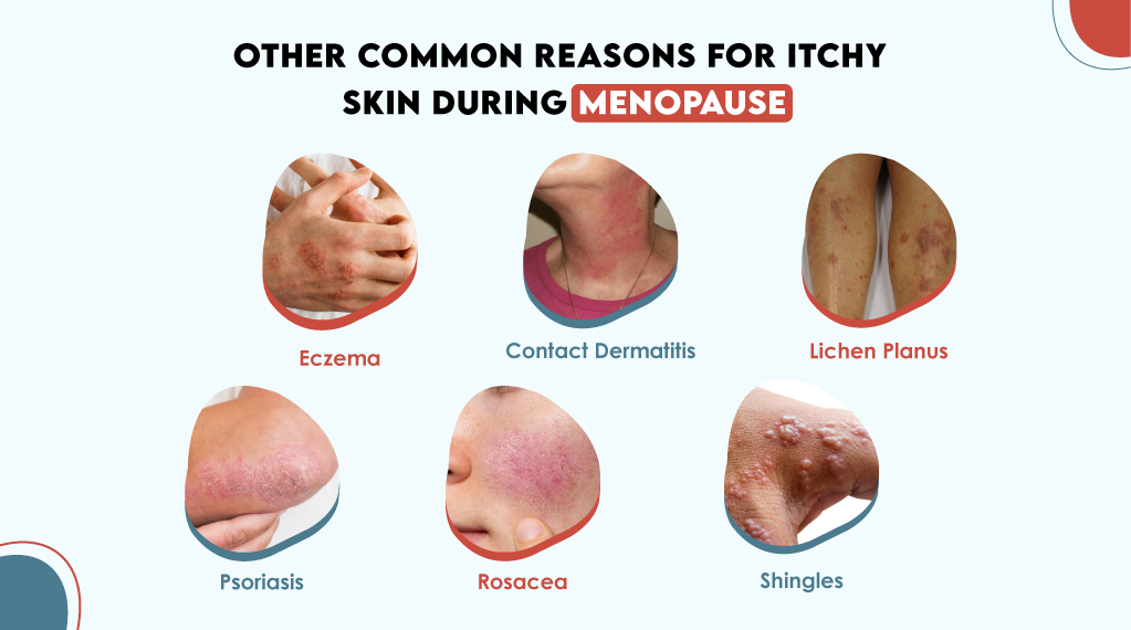 Other Common Reasons for Itchy Skin During Menopause Other Common Reasons for Itchy Skin During Menopause
