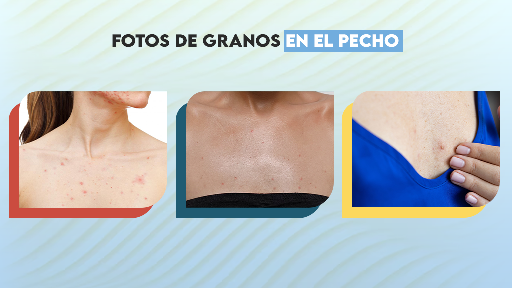 Fotos de granos en el pecho