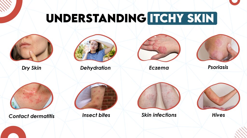 Understanding Itchy Skin 
