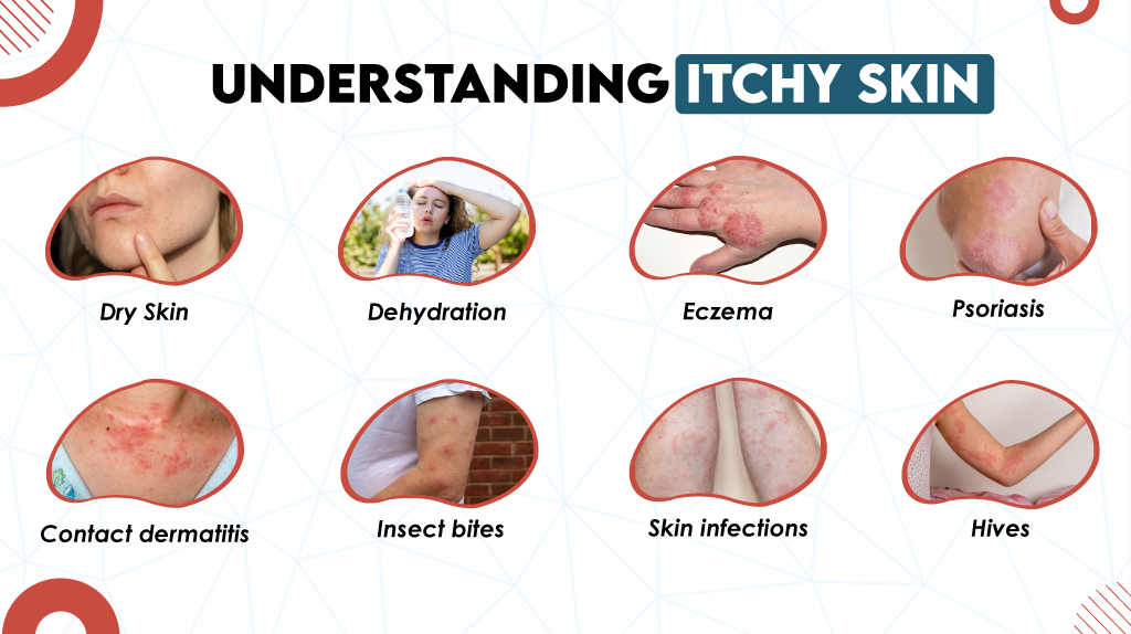 Understanding Itchy Skin 