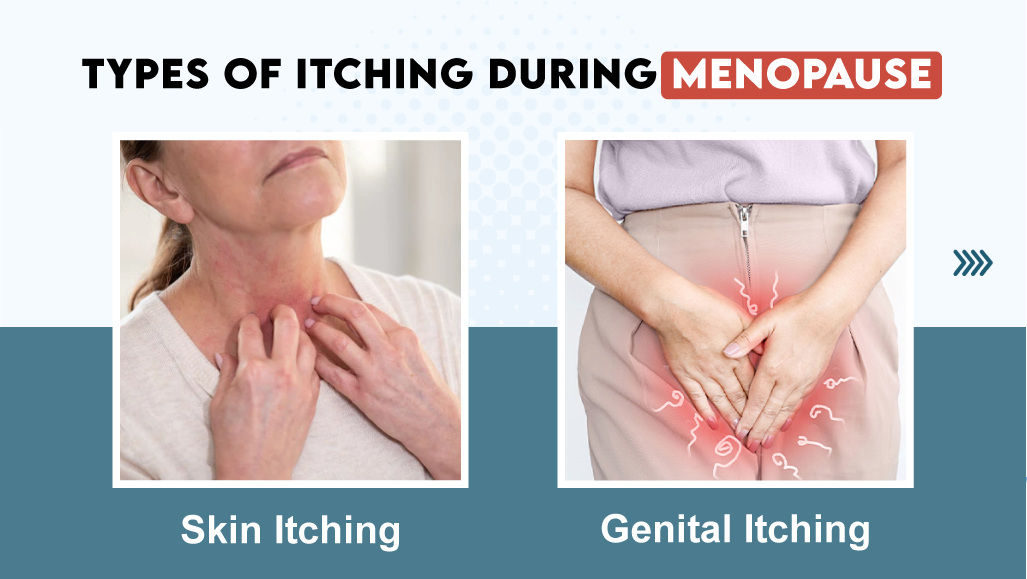 Types of Itching During Menopause