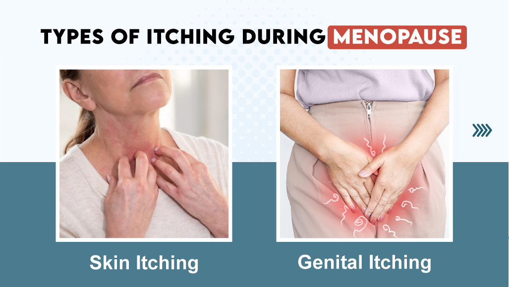 Types of Itching During Menopause Types of Itching During Menopause