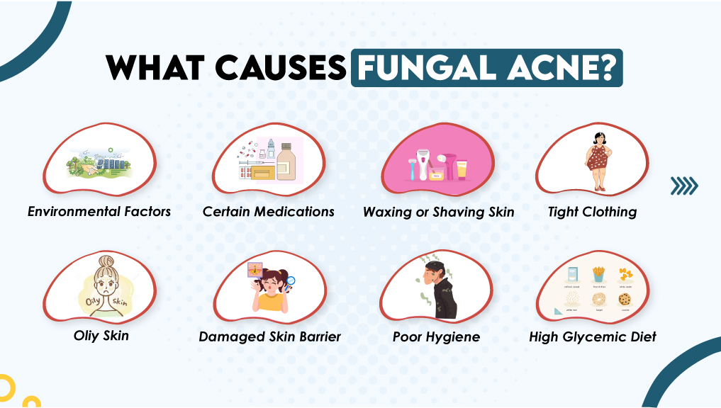 What Causes Fungal Acne?