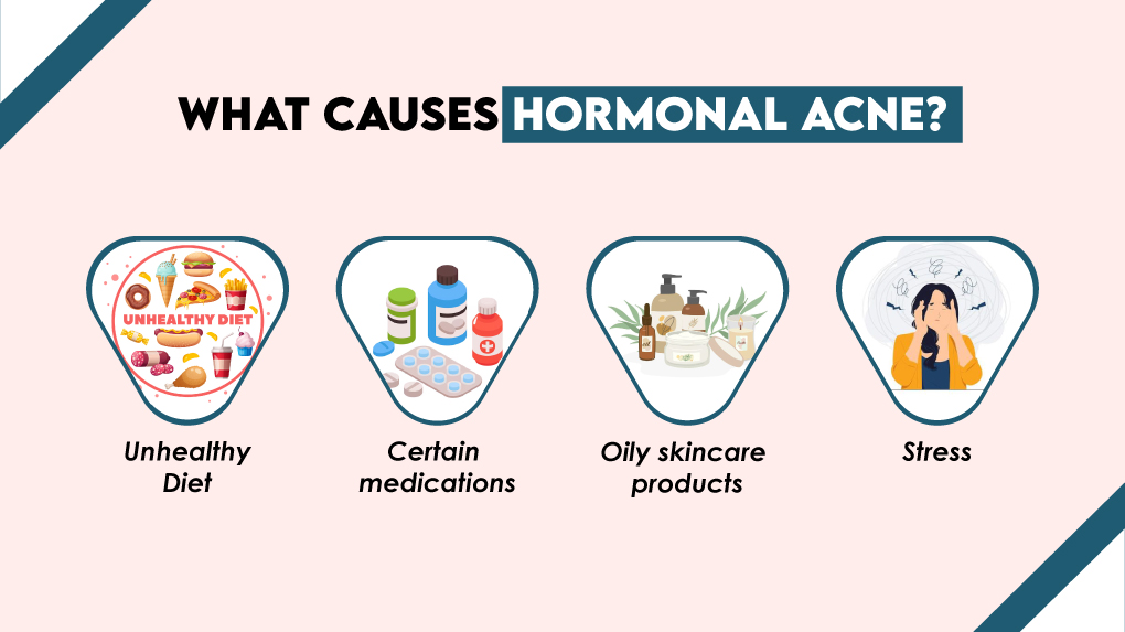 What Causes Hormonal Acne?