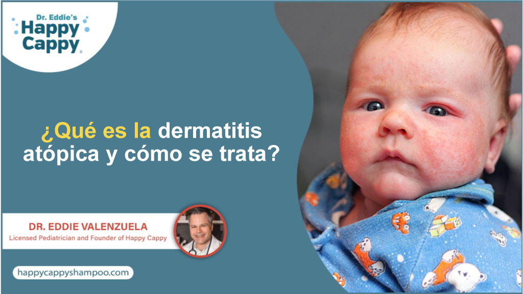 ¿Qué es la dermatitis atópica y cómo se trata?