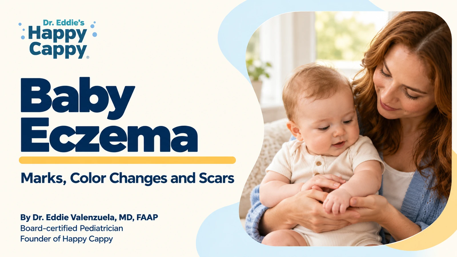 Baby Eczema: Marks, Color Changes and Scars