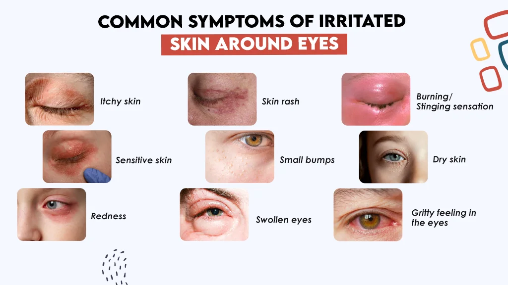 Common Symptoms of Irritated Skin Around Eyes