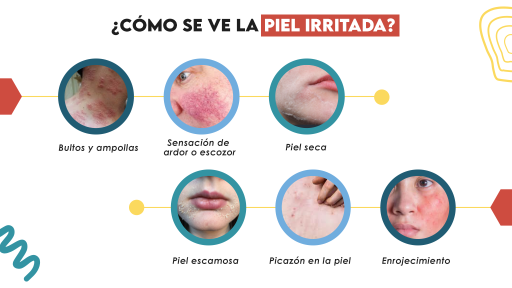 ¿Cómo se ve la piel irritada?