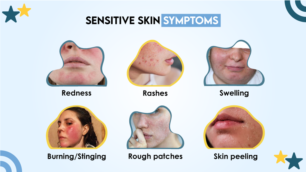 Sensitive Skin Symptoms