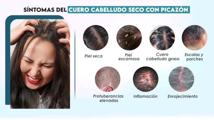 Picazon en la Cabeza: Unicorn Headwear Trend for Bold Style Statement