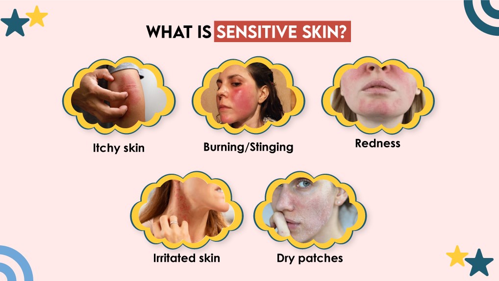 What is Sensitive Skin? 